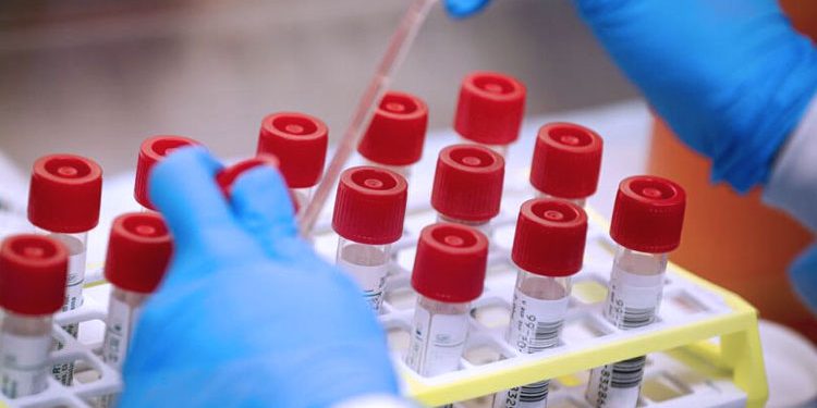 Hasil Rapid Test, Adik Kandung TKI Majalengka Negatif Corona