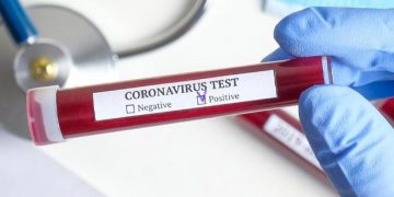 Satu Perawat RSD Gunung Jati Positif Covid-19