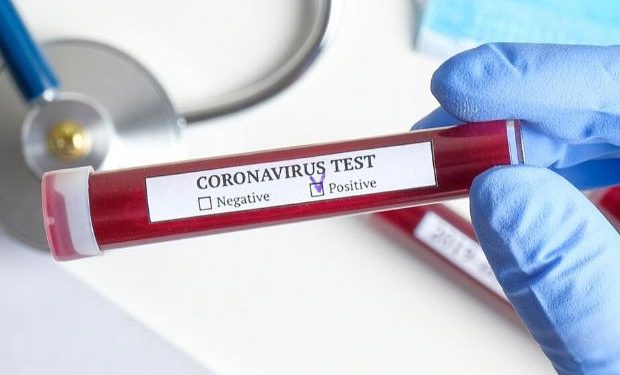 Satu Perawat RSD Gunung Jati Positif Covid-19