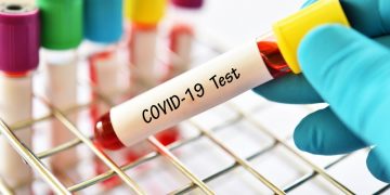 Test Swab Massal di Kuningan Targetkan 1.480 Orang