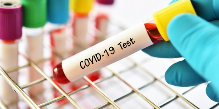 Test Swab Massal di Kuningan Targetkan 1.480 Orang