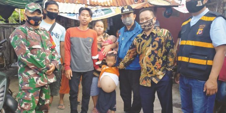 Balita Penderita Kanker Ginjal Segera Jalani Operasi di RSHS