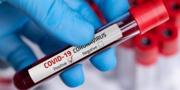 Pulang Demo, Perangkat Desa Positif Terinfeksi Virus Corona