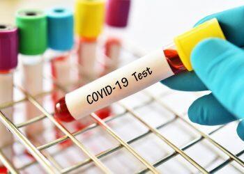 Hasil Swab 33 Orang Penyelenggara Pemilu Negatif Covid-19
