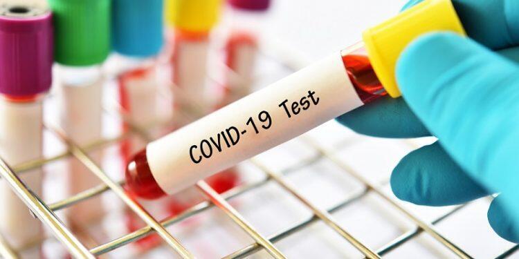 Hasil Swab 33 Orang Penyelenggara Pemilu Negatif Covid-19
