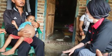 Selly Kunjungi Bocah Penderita Tumor di Desa Tanjungkerta