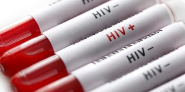 24 Bumil di Kabupaten Cirebon Positif HIV