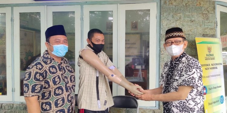 14 Tahun Tidak Memiliki Tangan, Apin Dapat Bantuan Tangan Palsu