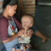 Balita 5 Tahun di Indramayu Menderita Hidrosefalus