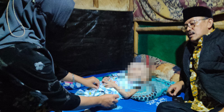 Anak Penderita Hidrosepalus Kurang Perawatan