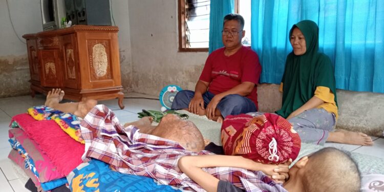 Tergolek Lemah Akibat Kanker Ganas, Revarina Ingin Sembuh dan Sekolah Lagi