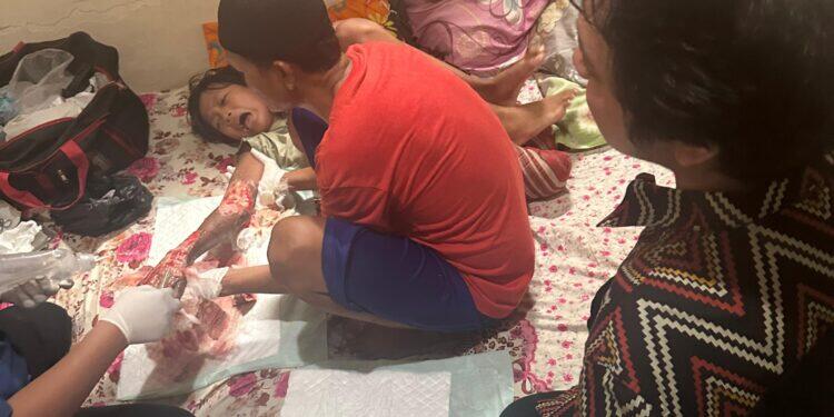 Akibat Digigit Ular Tanah, Tangan Dipay Melepuh