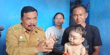 Vika Navadilla, Bocah 5 Tahun Penderita Kelenjar Getah Bening akan Dirujuk ke Rumah Sakit