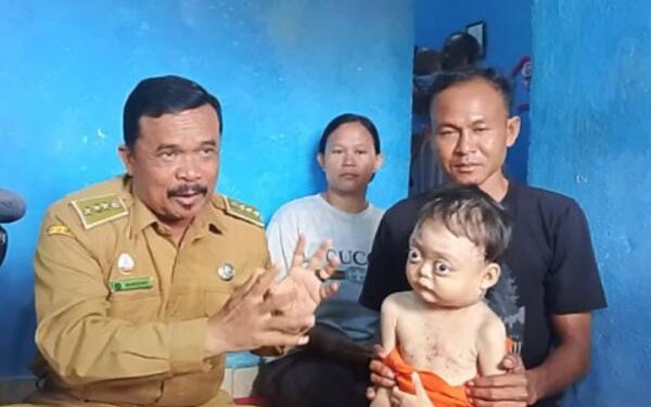 Vika Navadilla, Bocah 5 Tahun Penderita Kelenjar Getah Bening akan Dirujuk ke Rumah Sakit