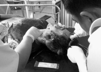 Pria di Cimara Dibacok Parang, Polisi Dalami Motif Konflik Pribadi