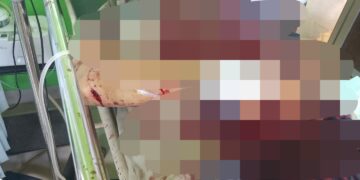 Pria Dibacok Usai Diajak Ngopi, Polisi Buru Pelaku ke Kawasan Hutan