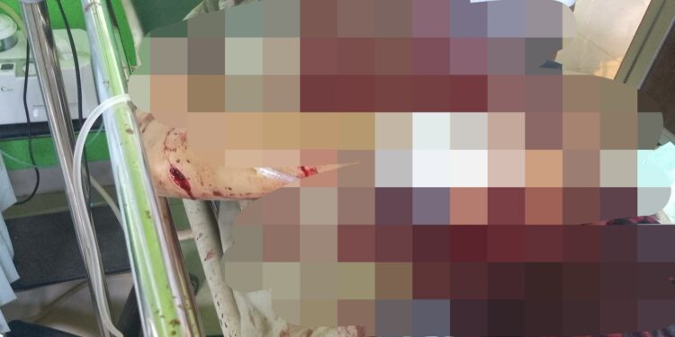 Pria Dibacok Usai Diajak Ngopi, Polisi Buru Pelaku ke Kawasan Hutan